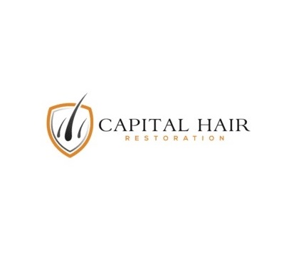 Capital Hair Restoration - Hair Transplant  Watford